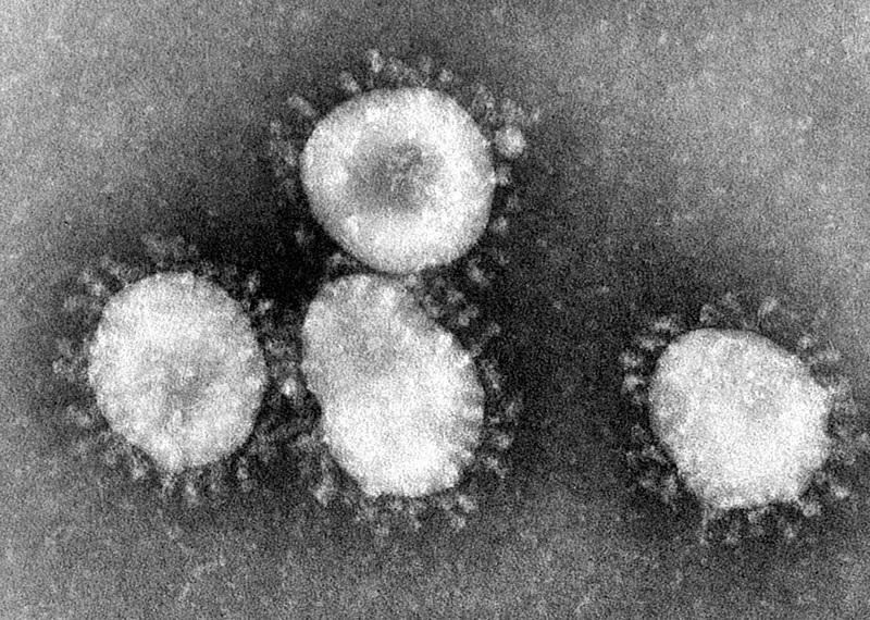coronavirus -1